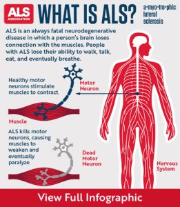 ALS Disease